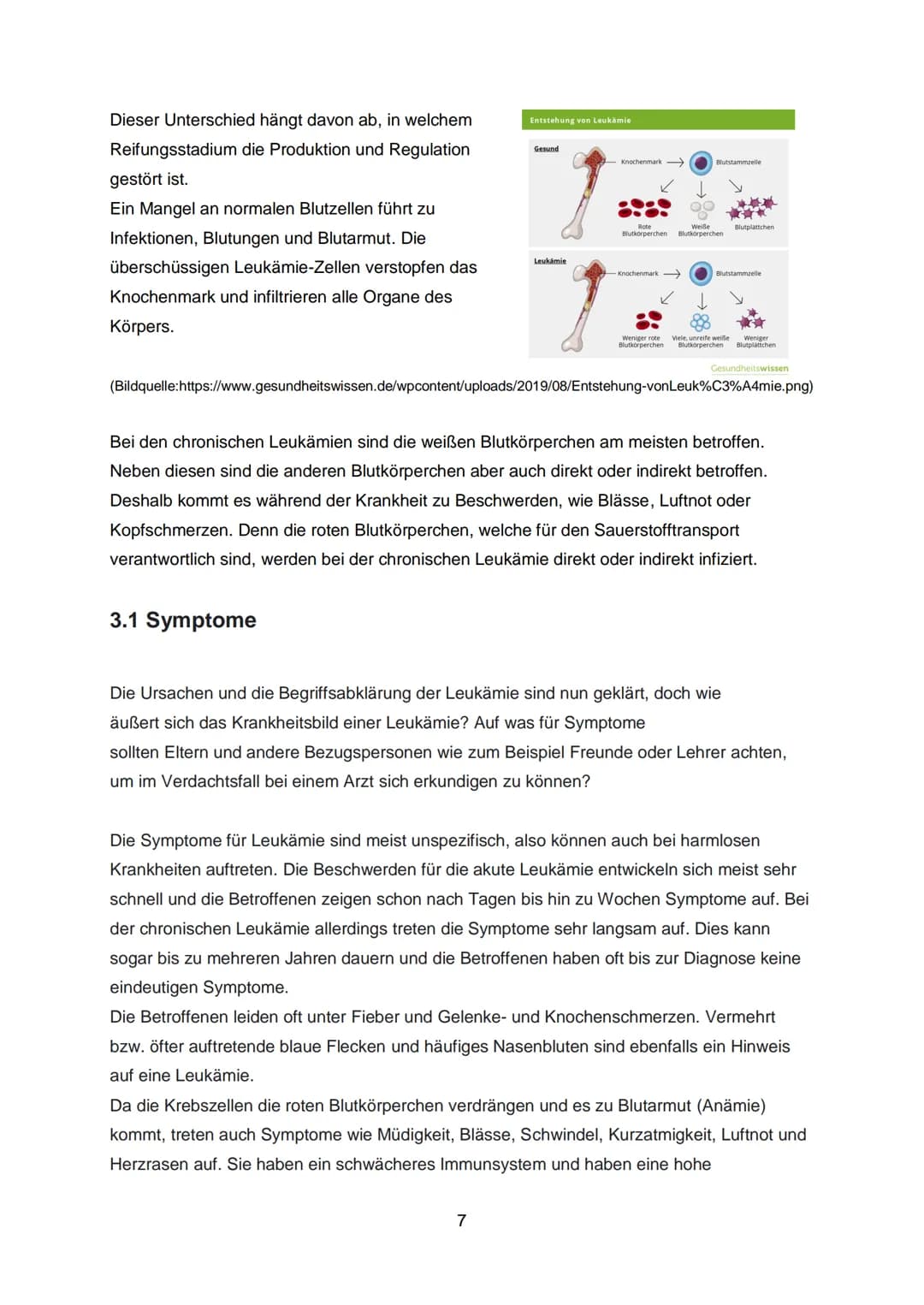 Inhaltsverzeichnis:
1. Einleitung...
1.1 Was ist Blut?
1.2 Was ist Leukämie?
2. Welche Arten gibt es?
2.. Akute lymphatische Leukämie (ALL)

