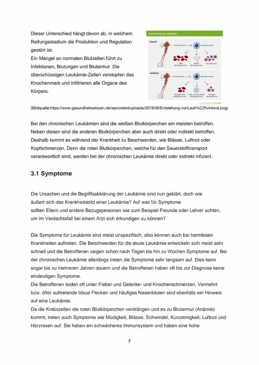 Inhaltsverzeichnis:
1. Einleitung...
1.1 Was ist Blut?
1.2 Was ist Leukämie?
2. Welche Arten gibt es?
2.. Akute lymphatische Leukämie (ALL)
