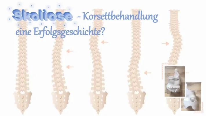 Know Skoliose (Verteidigung) thumbnail