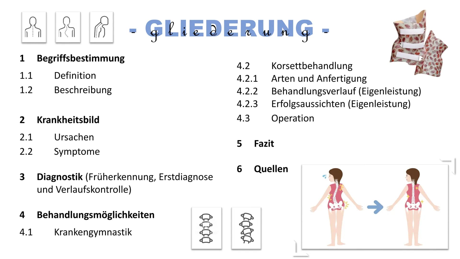 Skoliose -Korsettbehandlung
eine Erfolgsgeschichte? R
BS
1 Begriffsbestimmung
1.1
Definition
1.2 Beschreibung
2 Krankheitsbild
2.1 Ursachen
