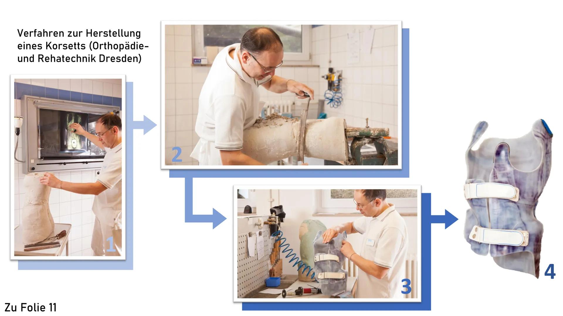 Skoliose -Korsettbehandlung
eine Erfolgsgeschichte? R
BS
1 Begriffsbestimmung
1.1
Definition
1.2 Beschreibung
2 Krankheitsbild
2.1 Ursachen
