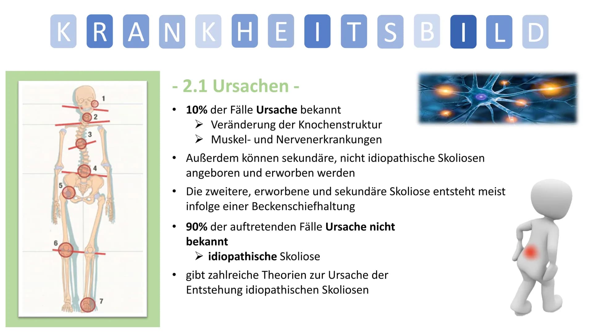 Skoliose -Korsettbehandlung
eine Erfolgsgeschichte? R
BS
1 Begriffsbestimmung
1.1
Definition
1.2 Beschreibung
2 Krankheitsbild
2.1 Ursachen
