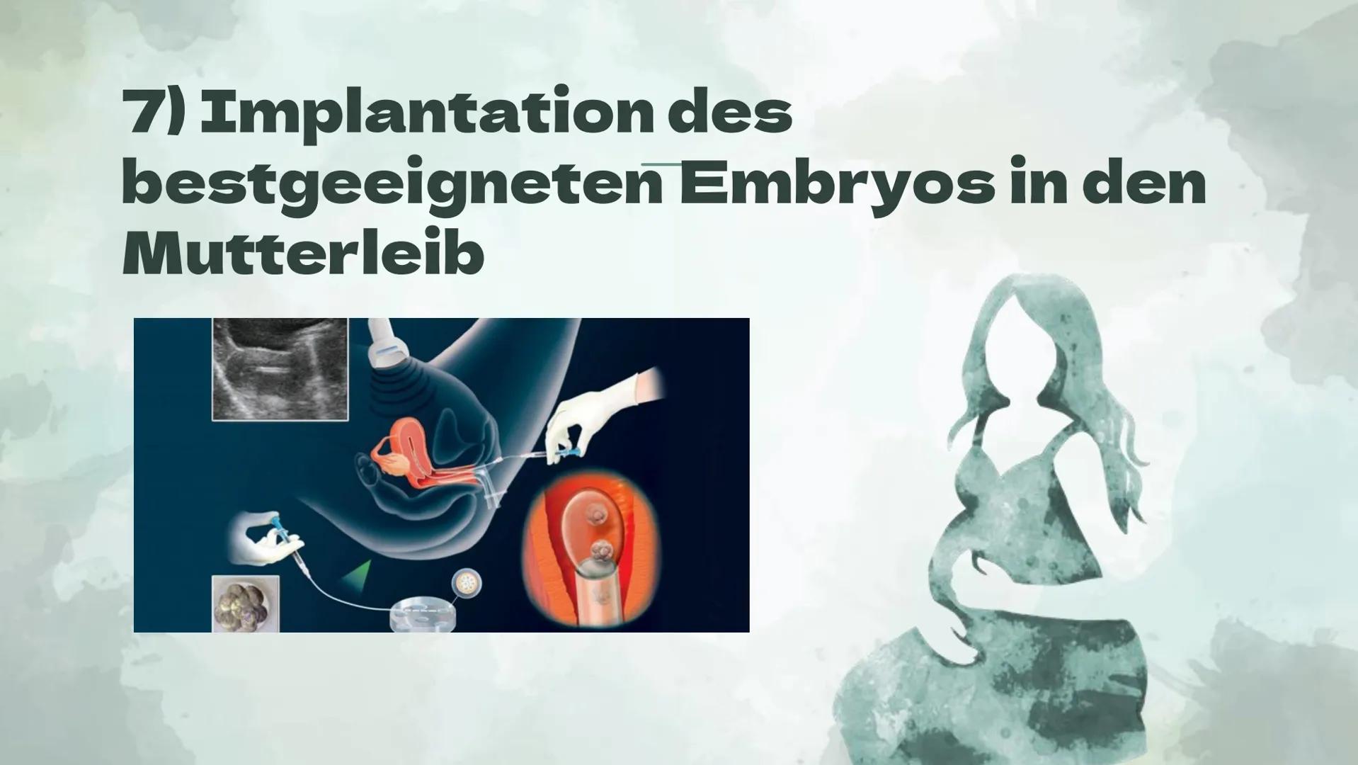 Präimplantationsdiagnostik
und Pränataldiagnostik
Von Alessiajoy Menzel, Theresa Schreiber und
Hannah Roth Inhaltsverzeichnis
1) Präimplanta