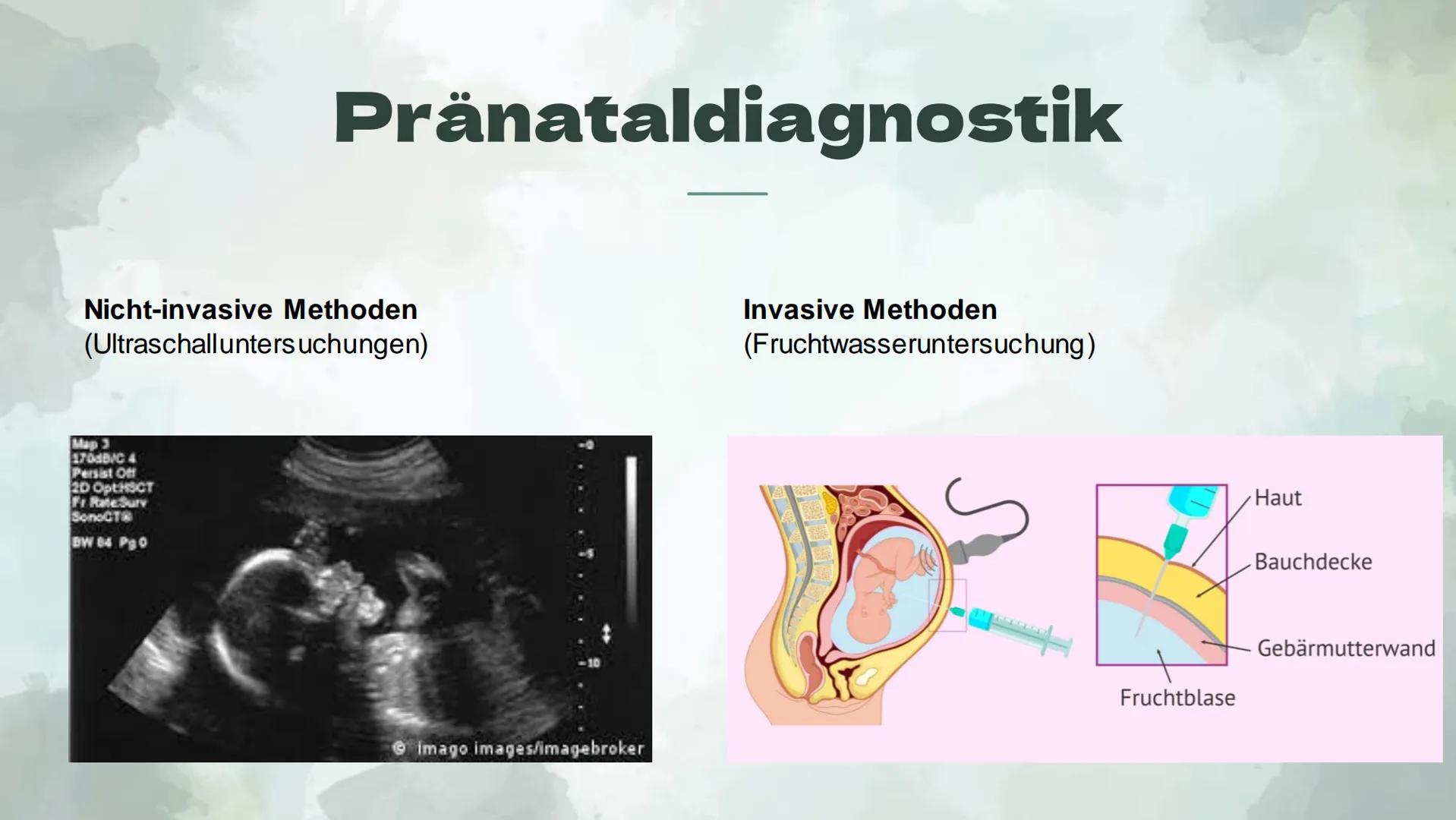 Präimplantationsdiagnostik
und Pränataldiagnostik
Von Alessiajoy Menzel, Theresa Schreiber und
Hannah Roth Inhaltsverzeichnis
1) Präimplanta