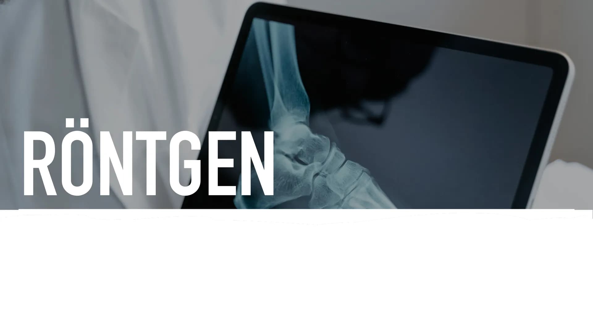 RÖNTGEN RÖNTGEN-LILLY PHILIP
INHALTSVERZEICHNIS
▸ Wilhelm Conrad Röntgen
▸ Allgemeine Infos
▸ Röntgenstrahlen
▸ Röntgenröhre
▸ Röhrenspannun