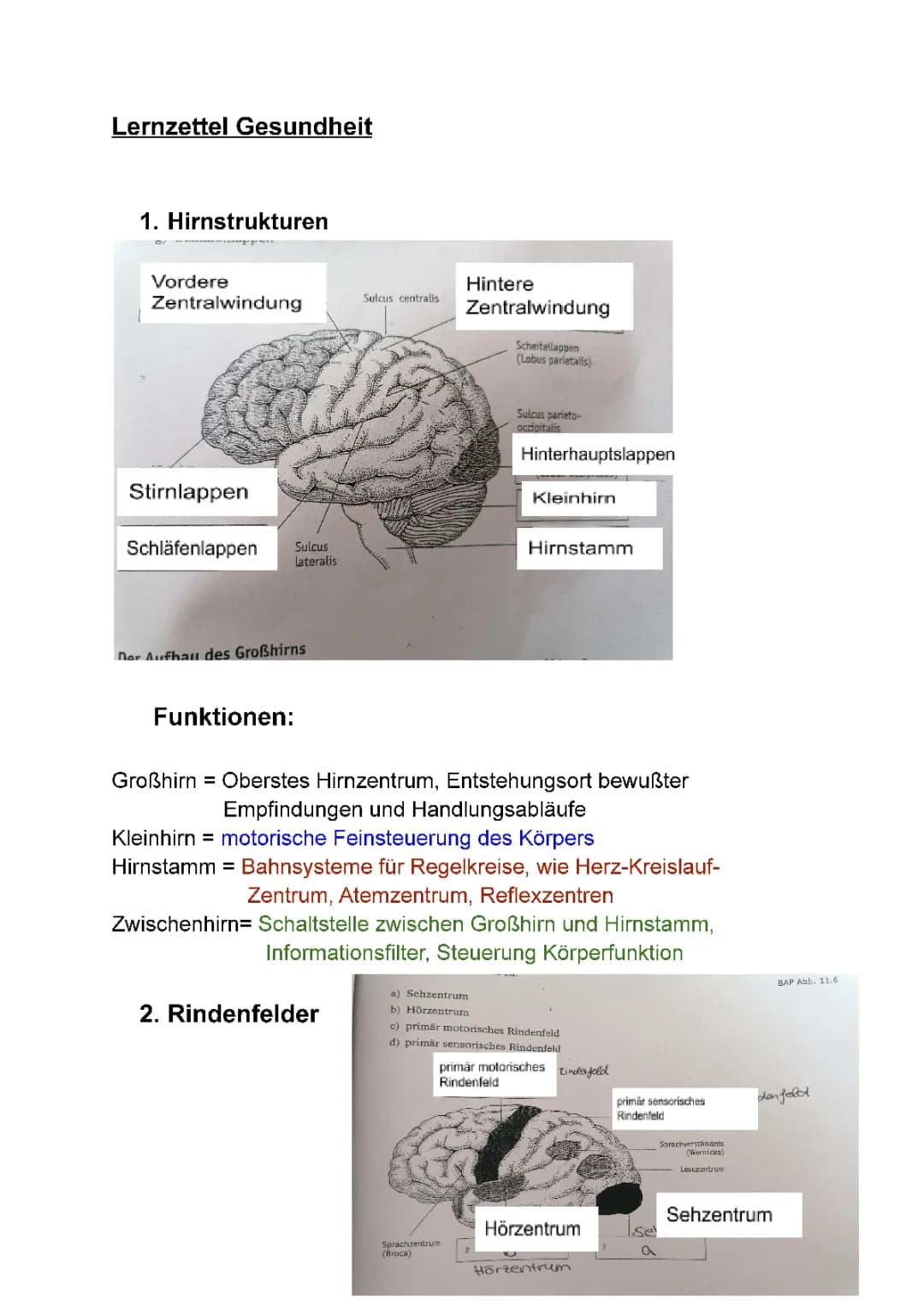 Multiple Sklerose Symptome und Ursachen - Lernzettel für Gesundheit LK 12/1