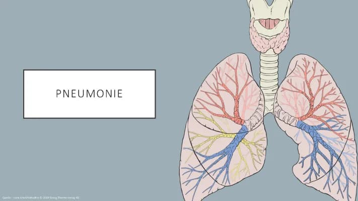 Know Pneumonie thumbnail