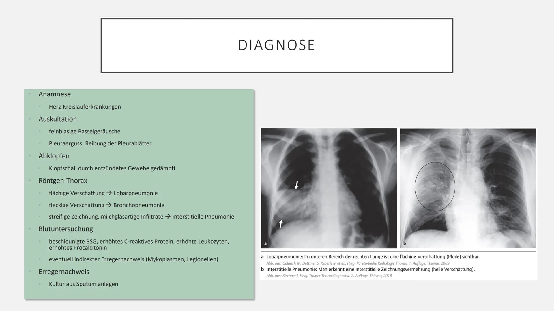 PNEUMONIE
Quelle: I care Krankheitslehre © 2019 Georg Thieme Verlag KG AGENDA
1. Definition
2. Pathophysiologie
3. Risikofaktoren
4. Symptom