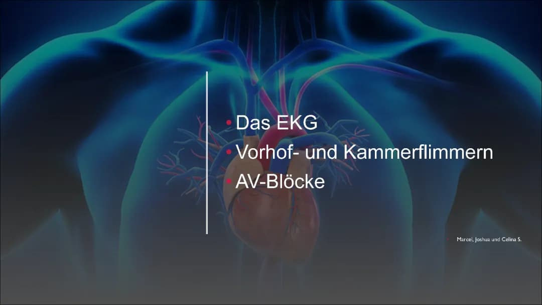 EKG, AV Blöcke & Vorhof- und Kammerflimmer 