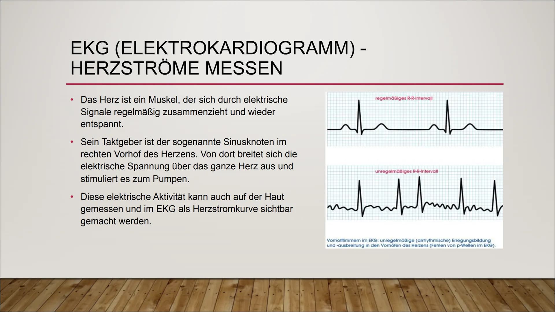 Das EKG
Vorhof- und Kammerflimmern
AV-Blöcke
Marcel, Joshua und Celina S. EKG (ELEKTROKARDIOGRAMM) -
HERZSTRÖME MESSEN
●
Das Herz ist ein Mu