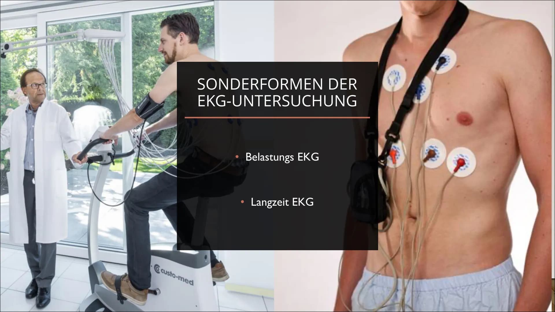 Das EKG
Vorhof- und Kammerflimmern
AV-Blöcke
Marcel, Joshua und Celina S. EKG (ELEKTROKARDIOGRAMM) -
HERZSTRÖME MESSEN
●
Das Herz ist ein Mu