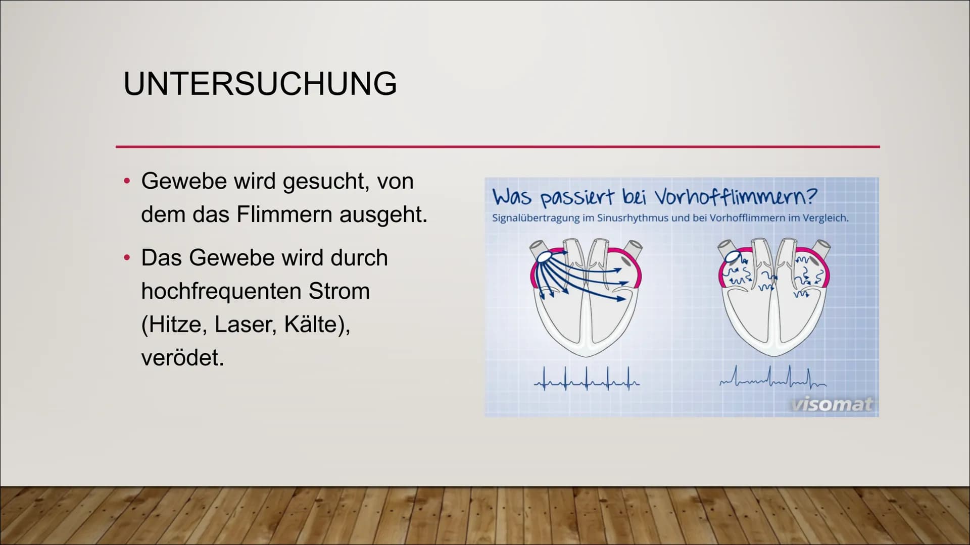 Das EKG
Vorhof- und Kammerflimmern
AV-Blöcke
Marcel, Joshua und Celina S. EKG (ELEKTROKARDIOGRAMM) -
HERZSTRÖME MESSEN
●
Das Herz ist ein Mu