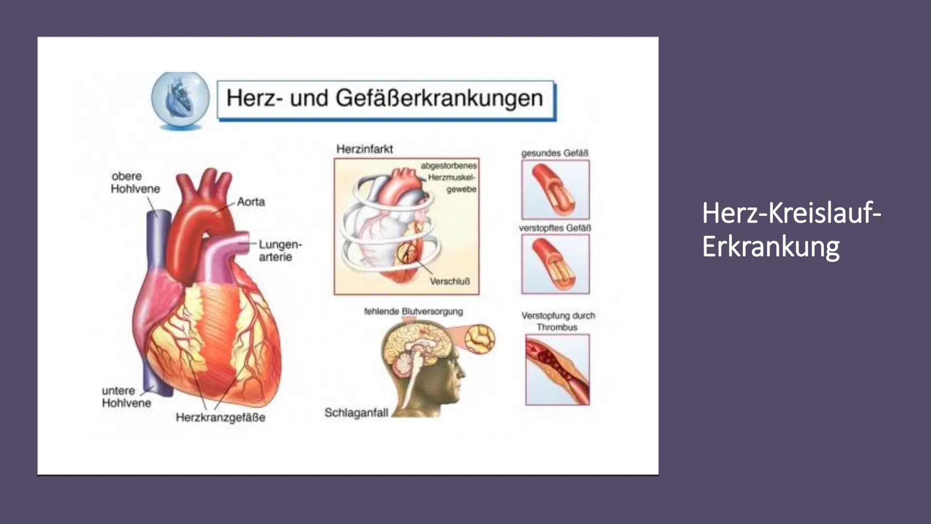 Herz-Kreislauf-
System
W obere Hohlvene
Aorta
Herz
Lebervene
Lungenaterie
Lungenvene(n)
untere Hohlvene
Nierenvene
Inhaltsverzeichnis
1.
2.
