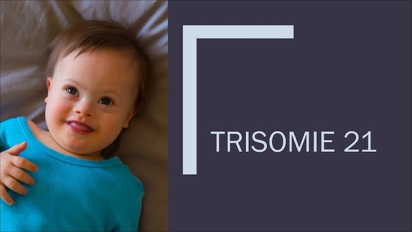 GENOMMUTATION
Am Beispiel von Trisomie Gliederung
Was sind Genommutationen?
Trisomie 21
Trisomie 13 & 18
Pränatale Diagnostik WAS SIND
GENOM
