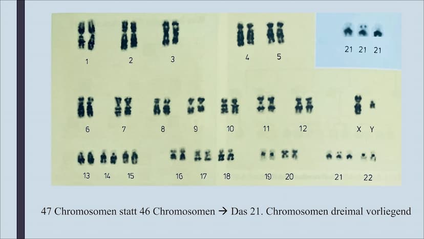 GENOMMUTATION
Am Beispiel von Trisomie Gliederung
Was sind Genommutationen?
Trisomie 21
Trisomie 13 & 18
Pränatale Diagnostik WAS SIND
GENOM
