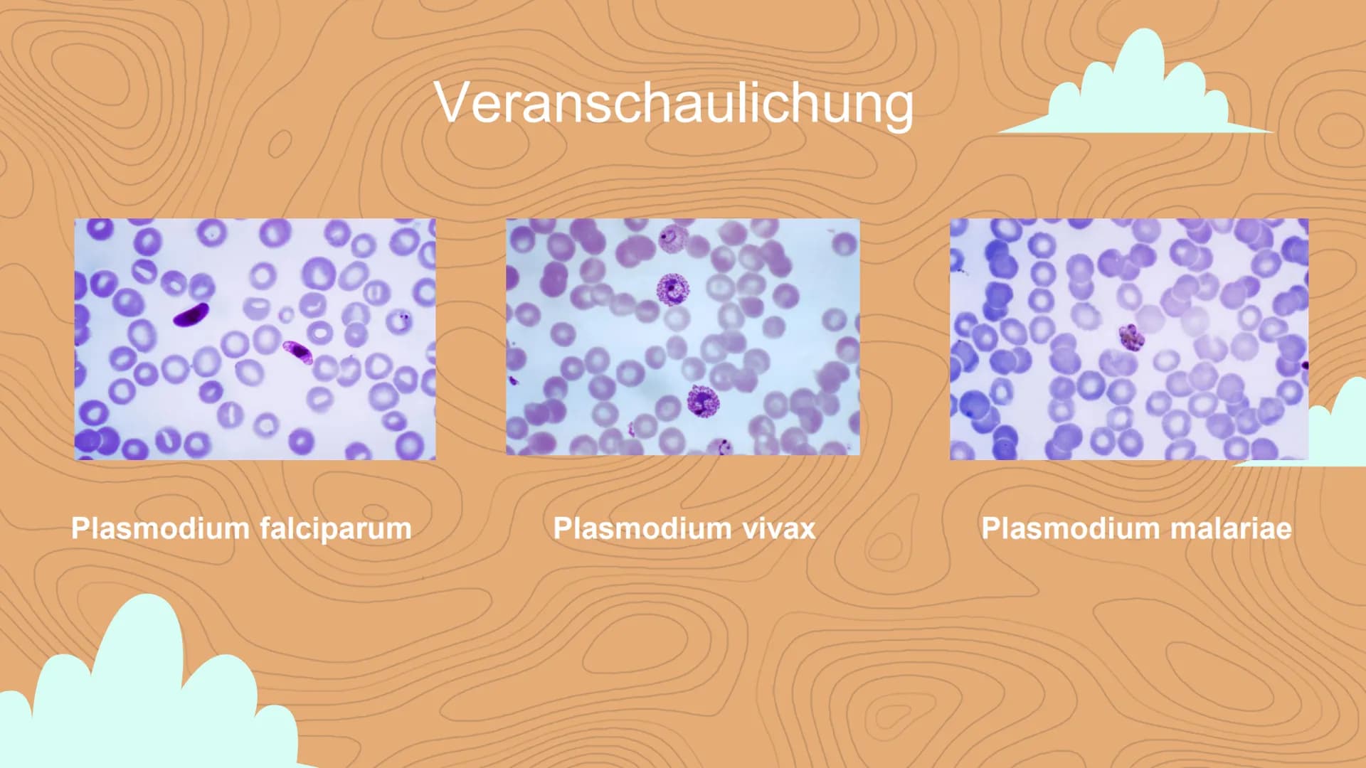 Malaria
Negin David
C Inhaltsverzeichnis
Einstieg in das Thema
WHO- Statistik
• 3 Arten von Malaria
Veranschaulichung
Erreger / die Anophele