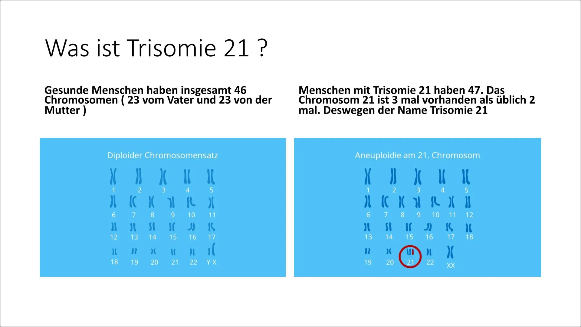 Down Syndrom/Trisomie 21
Power Point Präsentation von
Max Inhaltsverzeichnis
•
Was ist Trisomie 21 ?
• Geschichte von Trisomie 21
• Wie komm