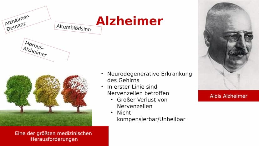 Gesundes Hirn
38
Alzheimer-Demenz
Hirnrinde
Hippocampus
GFS Biologie
Fortgeschrittene Alzheimer-Krankheit
Stark
- geschrumpfte
Rinde
Extrem
