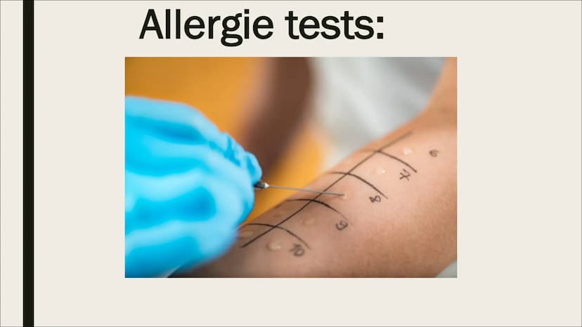 BIOLOGIE-ALLERGIE Gliederung
1. Was ist eine Allergie?
2. Wie entsteht eine Allergie?
3. Wie stelle ich eine Allergie fest?
4. Verschiedene 