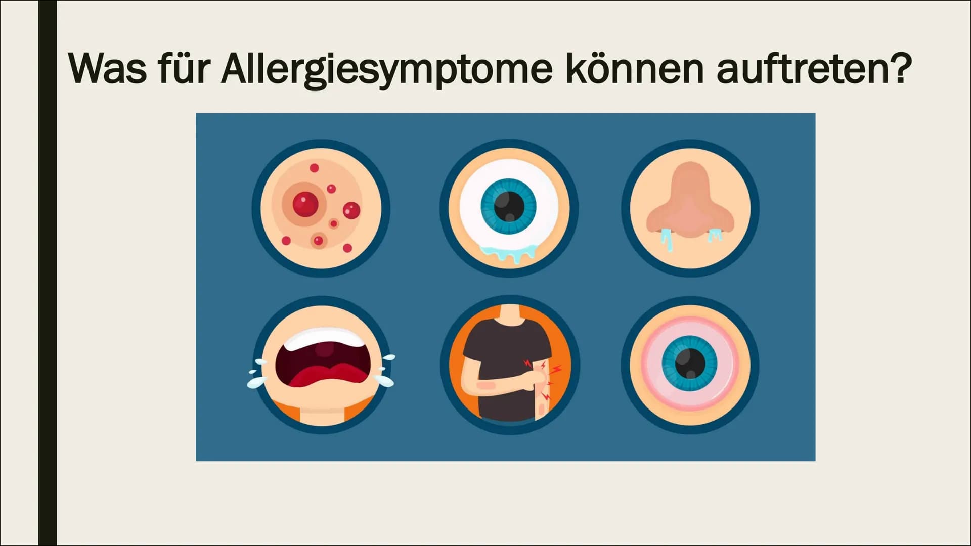 BIOLOGIE-ALLERGIE Gliederung
1. Was ist eine Allergie?
2. Wie entsteht eine Allergie?
3. Wie stelle ich eine Allergie fest?
4. Verschiedene 