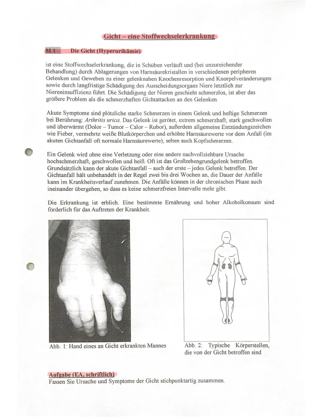 Gicht - eine Stoffwechselerkrankung
M1 Die Gicht (Hyperurikämie)
ist eine Stoffwechselerkrankung, die in Schüben verläuft und (bei unzureich