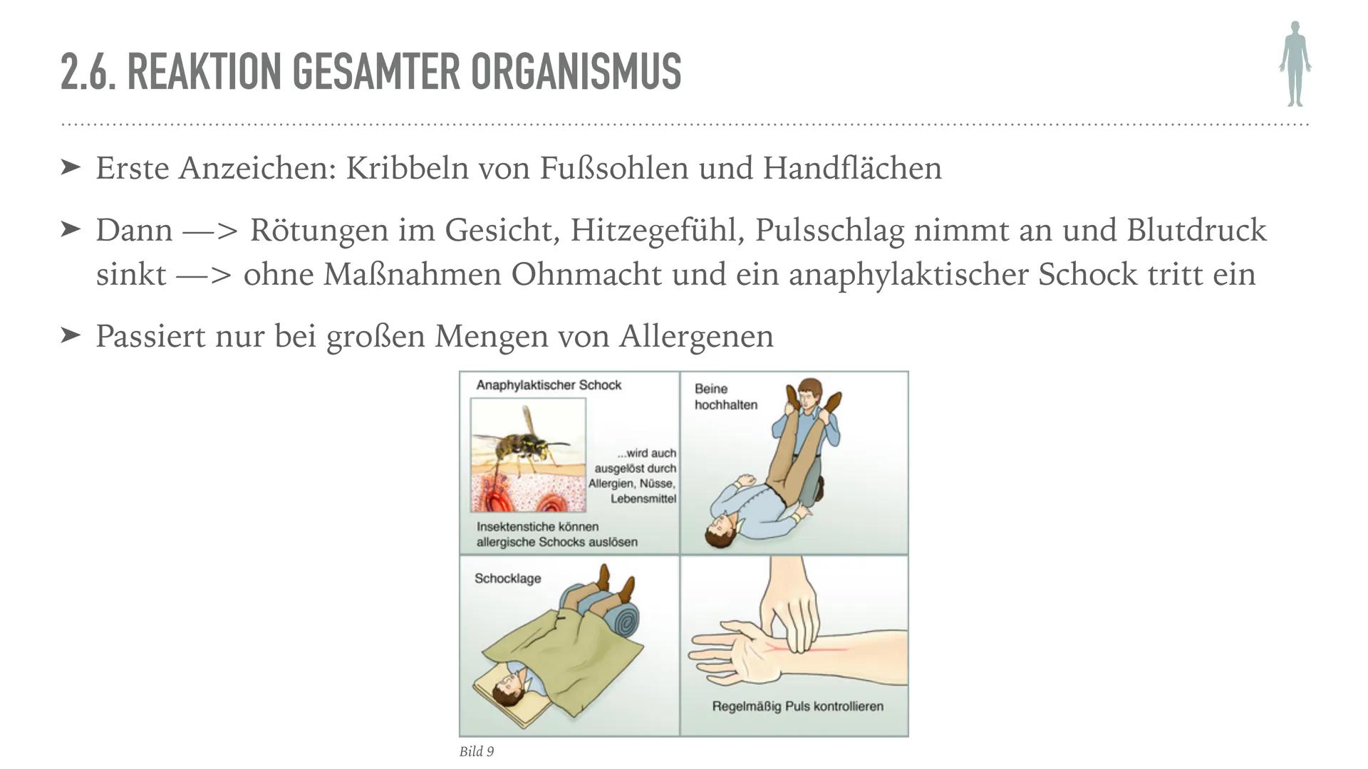 ALLERGIEN
Alicia Saalmann, Timo Streek und Helena Schulze INHALT
1. Wie entsteht eine Allergie?
2. Definition und Krankheitsbild
2.1. Reakti