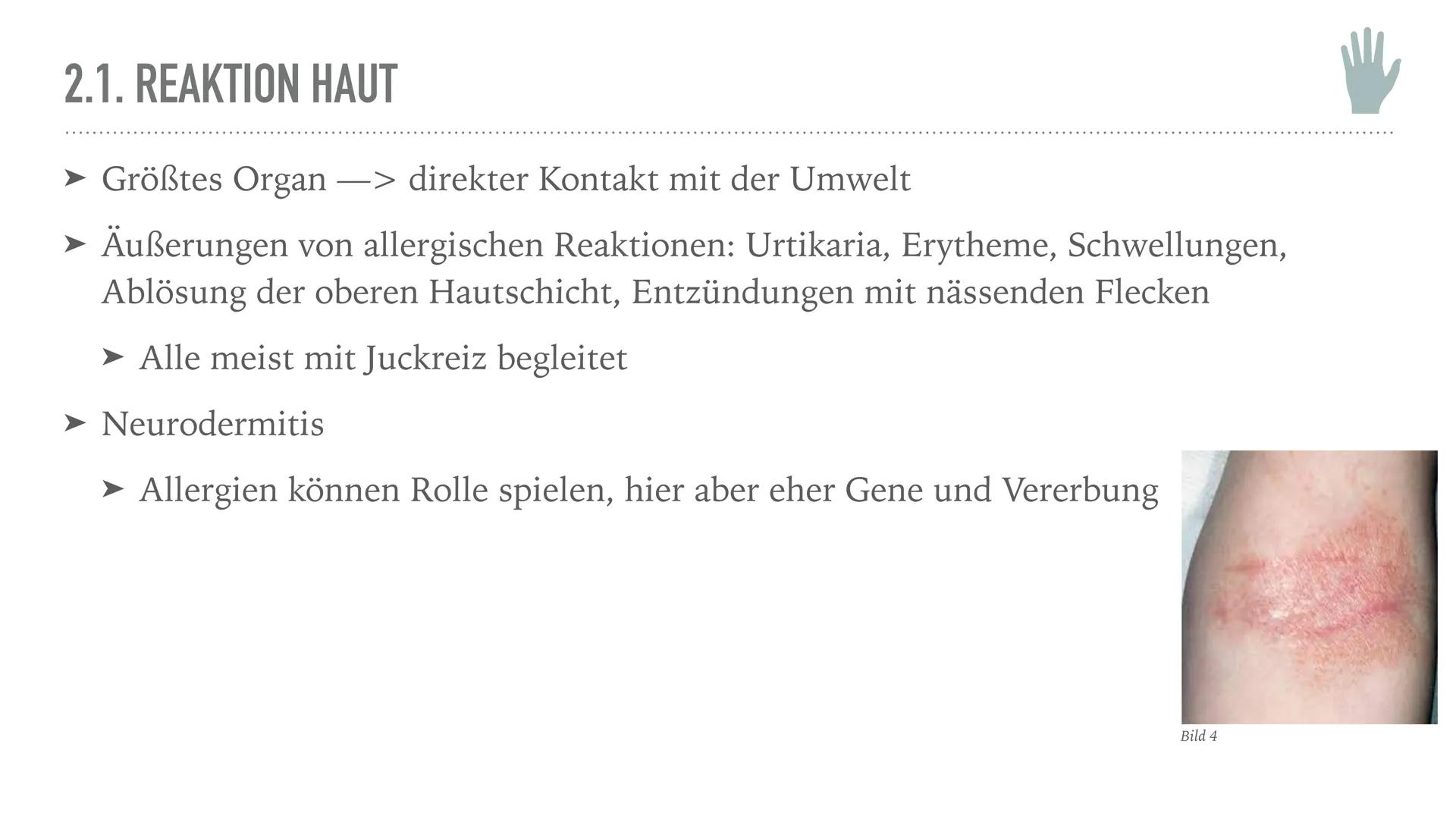 ALLERGIEN
Alicia Saalmann, Timo Streek und Helena Schulze INHALT
1. Wie entsteht eine Allergie?
2. Definition und Krankheitsbild
2.1. Reakti
