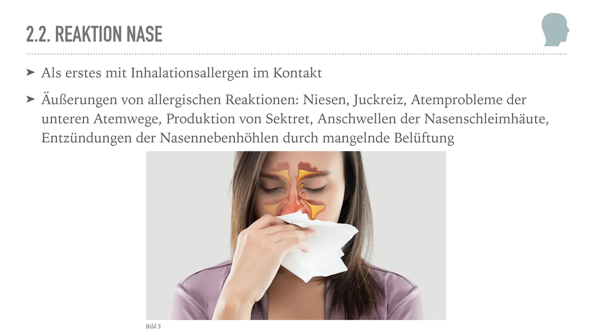 ALLERGIEN
Alicia Saalmann, Timo Streek und Helena Schulze INHALT
1. Wie entsteht eine Allergie?
2. Definition und Krankheitsbild
2.1. Reakti