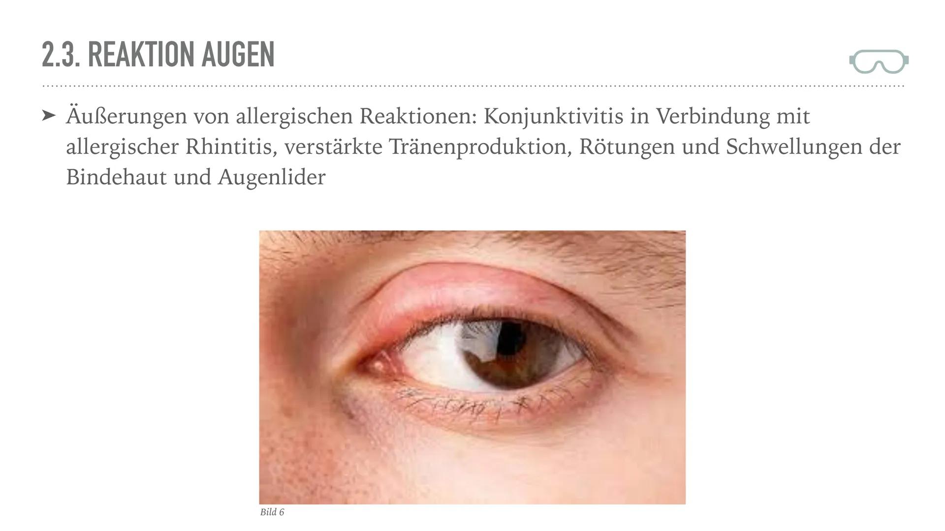 ALLERGIEN
Alicia Saalmann, Timo Streek und Helena Schulze INHALT
1. Wie entsteht eine Allergie?
2. Definition und Krankheitsbild
2.1. Reakti