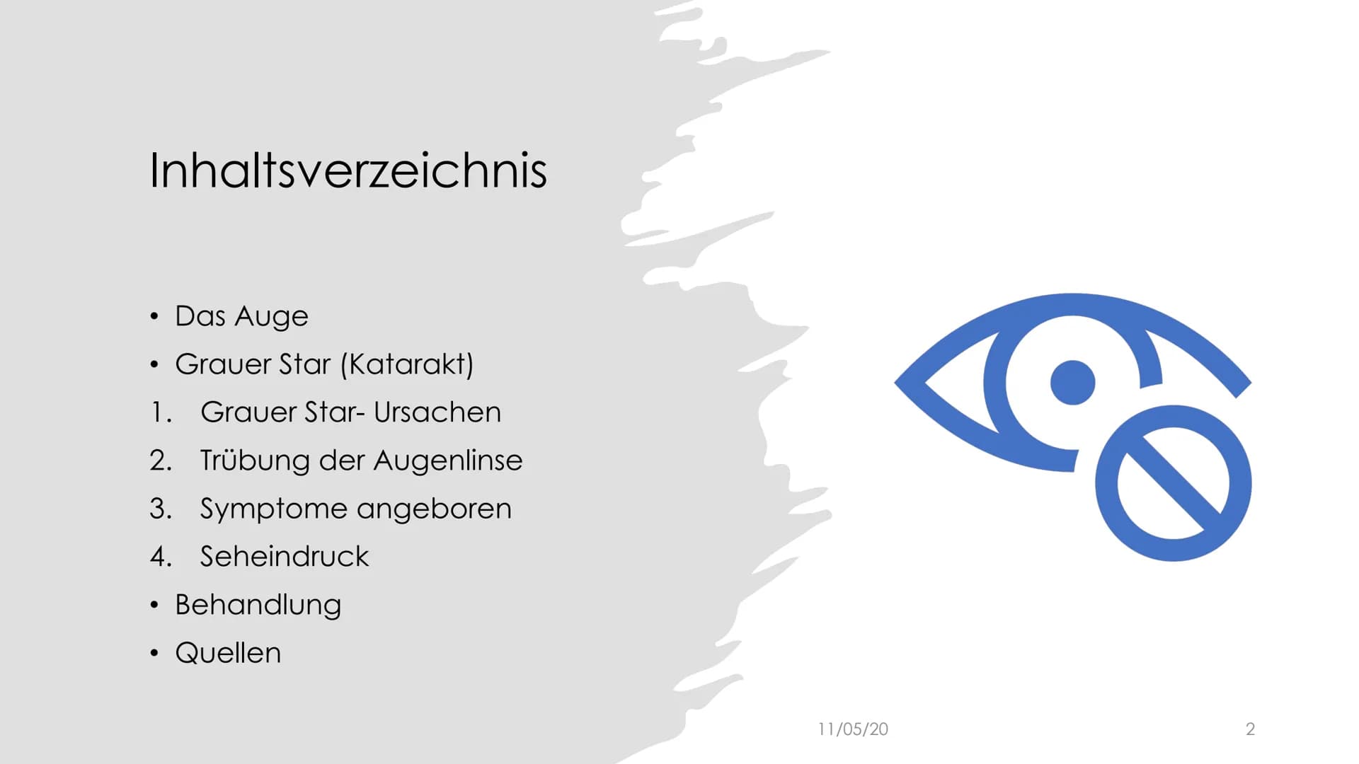 
<h2 id="ursachen">Ursachen</h2>
<p>Der Graue Star, auch bekannt als Katarakt, tritt in der Regel im Alter auf und resultiert in der Eintrüb