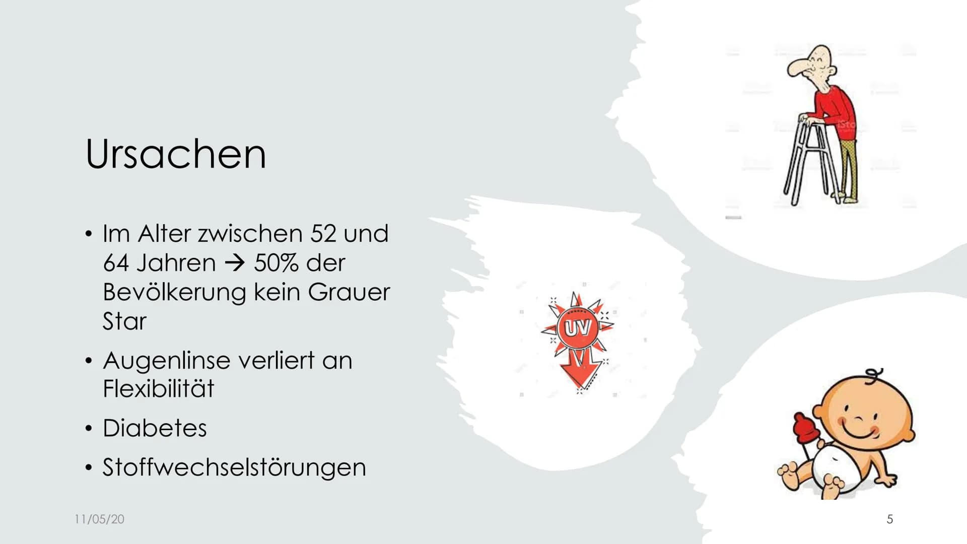 
<h2 id="ursachen">Ursachen</h2>
<p>Der Graue Star, auch bekannt als Katarakt, tritt in der Regel im Alter auf und resultiert in der Eintrüb