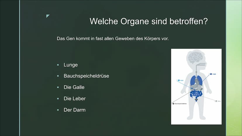 Von Fabienne Frentzen
Mukoviszidose ■
■
■
Was ist Mukoviszidose?
Wie wird Mukoviszidose vererbt?
Allgemeines Krankheitsbild
Welche Organe si