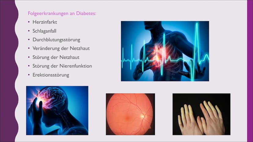 Diabetes I.
2.
GLIEDERUNG:
Was ist Diabetes?
Diabetestypen
2.1. Typ I
2.2 Typ 2
2.3 andere Typen
3. Insulin
3.1 Bedeutung & Aufgabe
3.2 Vera