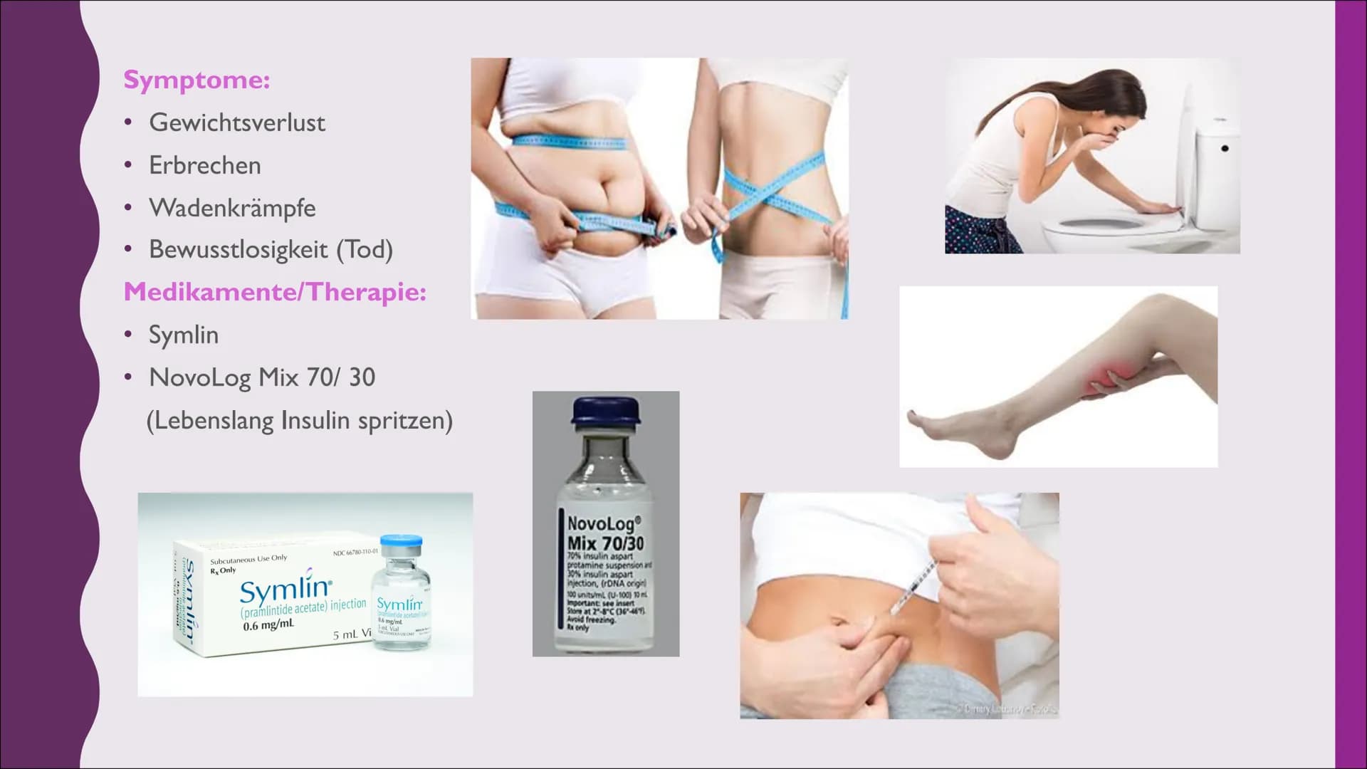 Diabetes I.
2.
GLIEDERUNG:
Was ist Diabetes?
Diabetestypen
2.1. Typ I
2.2 Typ 2
2.3 andere Typen
3. Insulin
3.1 Bedeutung & Aufgabe
3.2 Vera