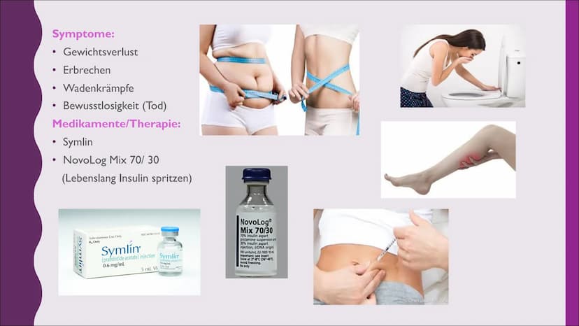 Diabetes I.
2.
GLIEDERUNG:
Was ist Diabetes?
Diabetestypen
2.1. Typ I
2.2 Typ 2
2.3 andere Typen
3. Insulin
3.1 Bedeutung & Aufgabe
3.2 Vera
