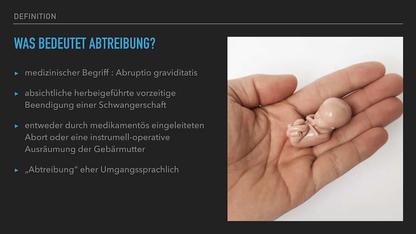 PRÄSENTATION VON JONAS IQBAL
ABTREIBUNG GLIEDERUNG
1. DEFINITION
2.
3. INDIKATION
4. METHODEN
5. FOLGEN
6. PFLEGEMABNAHMEN
7. MORALANSICHTEN