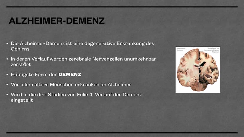 Demenz
MIRIAM& MATHILDE
*** Gliederung
●
●
●
Unterschiede Primäre und Sekundäre Demenz
• Welche Arten der Demenz gibt es?
●
●
●
●
Was bedeut