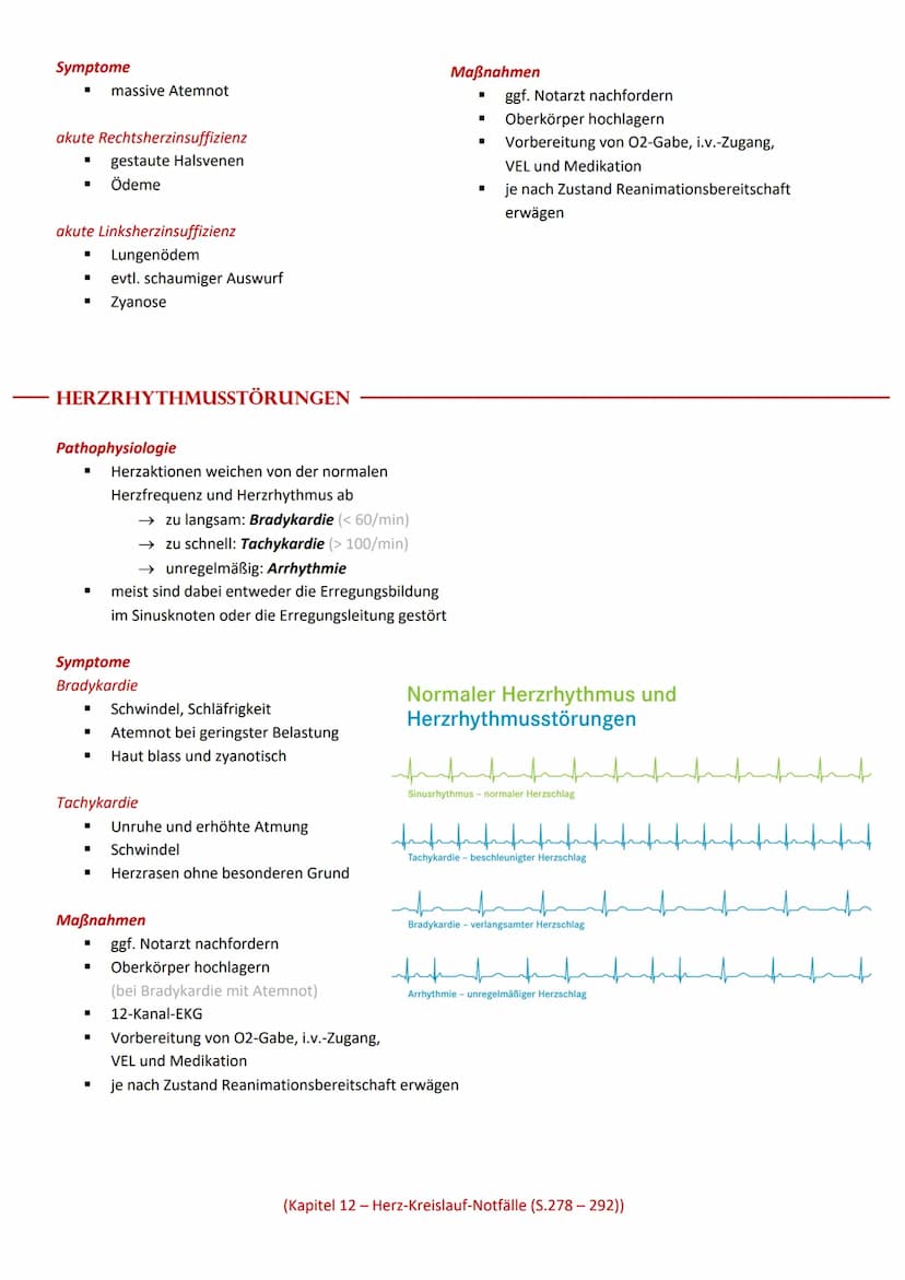 Wichtige Leitsymptome von Herz Kreislauf Störungen
■
Schmerzen & Engegefühl in der Brust (Angina pectoris)
■ Atemnot (Dyspnoe)
"
I
HERZ-KREI