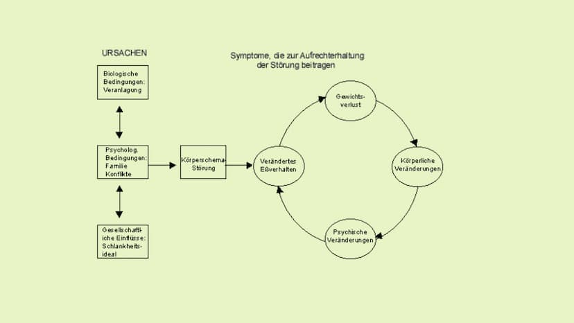 Essstörungen
►Welche Rolle spielt der mediale Schönheitswahn
bei der Entwicklung einer Essstörung?
79
91 Gliederung
► 1. Essstörung
► 2. Äti