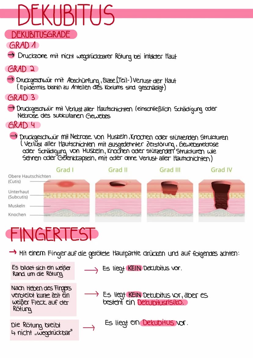DEKUBITUS
Was ist ein Dekubitus?
→ Der Dekubitus ist eine lokal begrenate Schädigung der Haut und des darunter liegenden
Gewebes. Der Dekubi