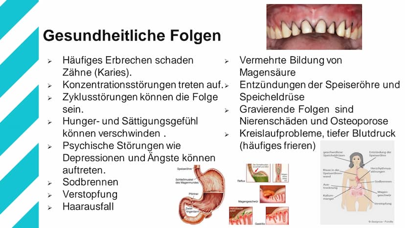 Bulimie Gliederung
1. Definition
2. Ursachen/Entstehung
3. Betroffene Personen
4. Verlauf der Krankheit
5. Symptome
6. Gesundheitliche Folge