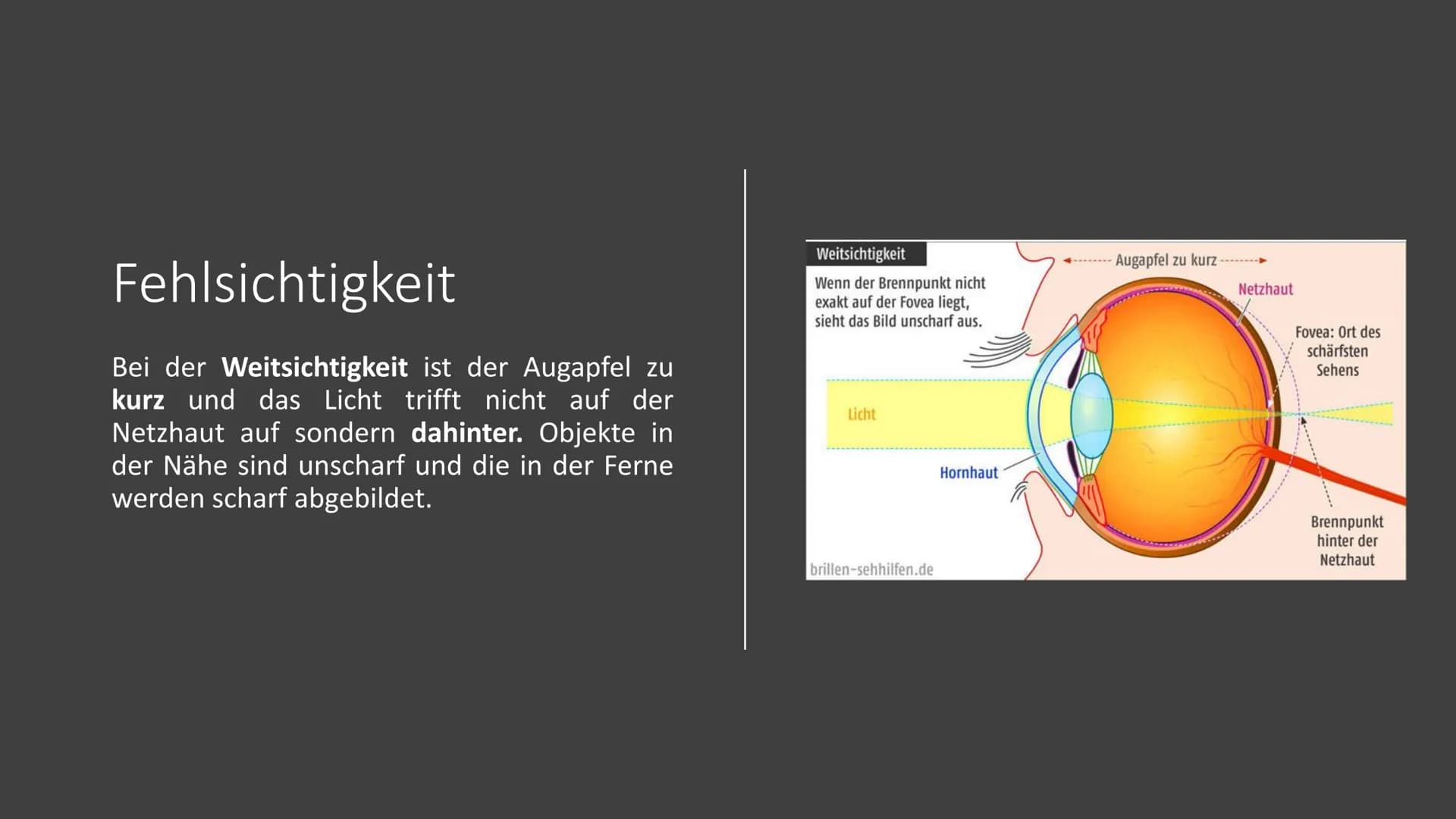 Präsentation
Die Brille
Zube Gliederung
1.
Geschichte
2. Arten von Brillen
3.
Fehlsichtigkeit
4.
5.
6. Quellen
Funktion der Brille
Dioptrien