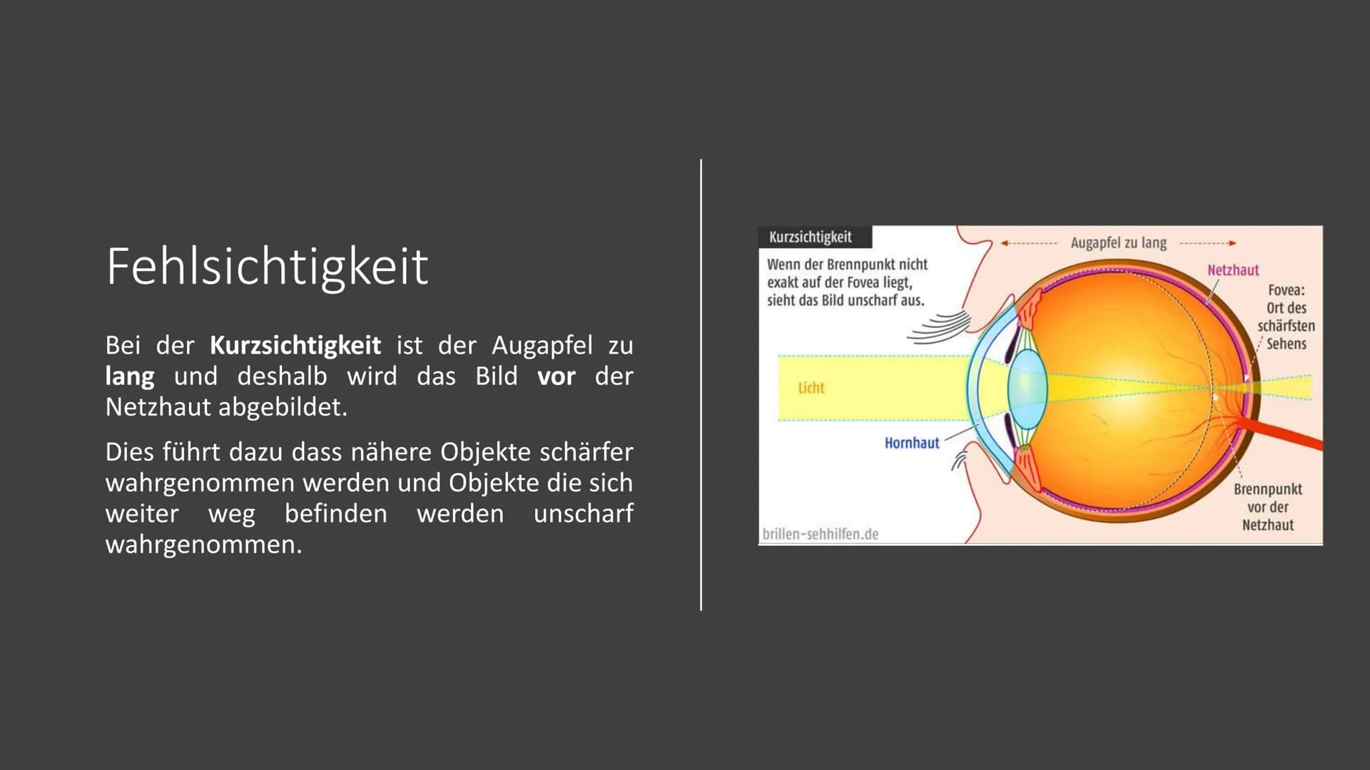 Präsentation
Die Brille
Zube Gliederung
1.
Geschichte
2. Arten von Brillen
3.
Fehlsichtigkeit
4.
5.
6. Quellen
Funktion der Brille
Dioptrien