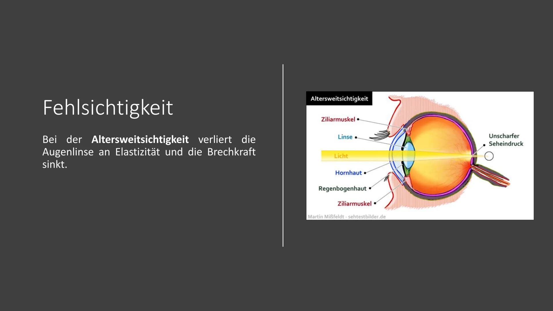 Präsentation
Die Brille
Zube Gliederung
1.
Geschichte
2. Arten von Brillen
3.
Fehlsichtigkeit
4.
5.
6. Quellen
Funktion der Brille
Dioptrien