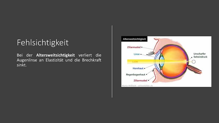 Präsentation
Die Brille
Zube Gliederung
1.
Geschichte
2. Arten von Brillen
3.
Fehlsichtigkeit
4.
5.
6. Quellen
Funktion der Brille
Dioptrien