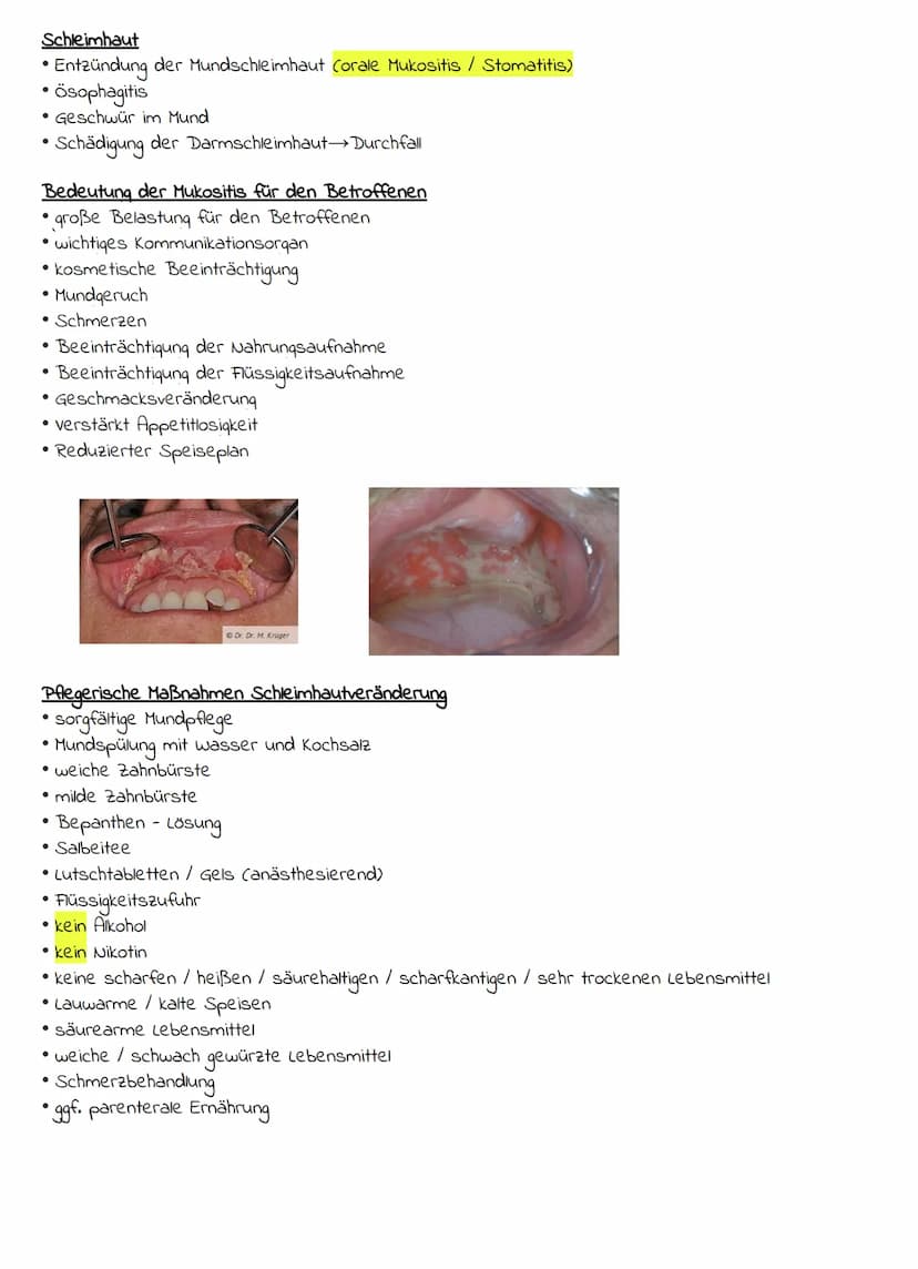 Definition
• ist eine Geschwulst
• Eine pathologische Zellansammlung durch überschießendes, unangenehmes wachstum körpereigener
Zellen
Form
