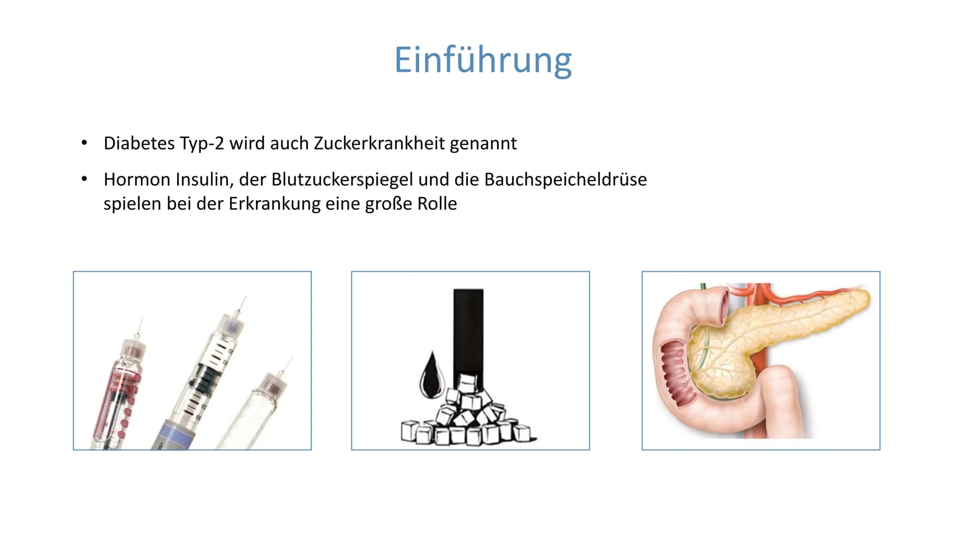 "Altersdiabetes"
im Jugendalter
Inwiefern ist die
Erkrankung heilbar?
lai Was ist Diabetes Typ 2?
Unterscheidung Diabetes Typ 1 und Typ 2
De