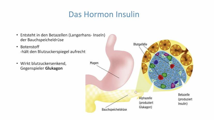 "Altersdiabetes"
im Jugendalter
Inwiefern ist die
Erkrankung heilbar?
lai Was ist Diabetes Typ 2?
Unterscheidung Diabetes Typ 1 und Typ 2
De