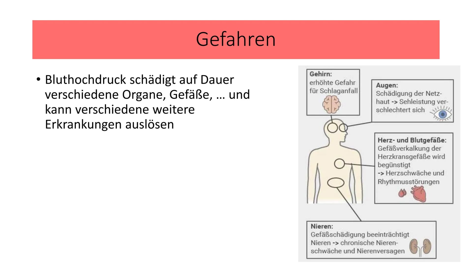 Bluthochdruck
Biologie / Klasse / Name / Datum Allgemein
• ,,arterille Hypertonie"
Der Blutdruck des arteriellen Gefäßsystems ist chronisch 