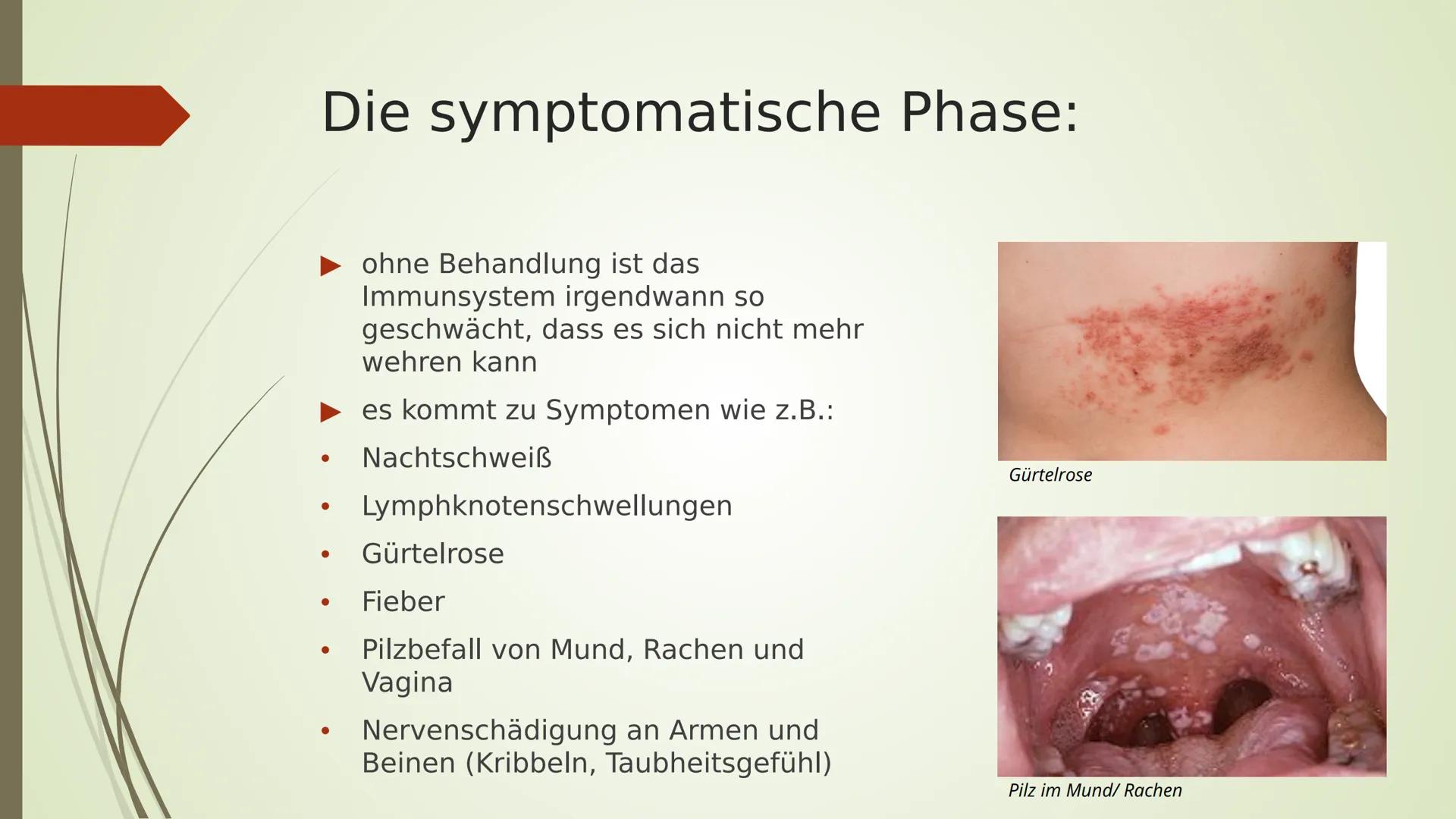 AIDS
HIV
YRITY Gliederung:
■ Arten
■
■
■
Allgemeines
Das HI-Virus
■
■ Geschichtliches
Übertragung
■ Ablauf/ Symptome
■
Aufbau
Woher kommt er